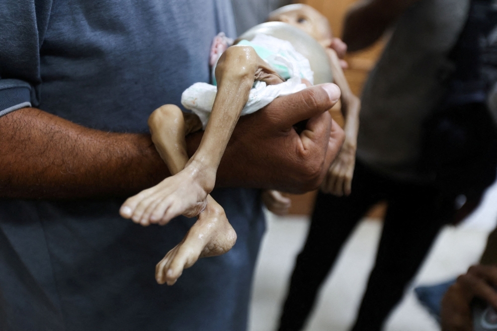 Hunger Is Killing Gaza’s Children – And It’s Entirely Preventable